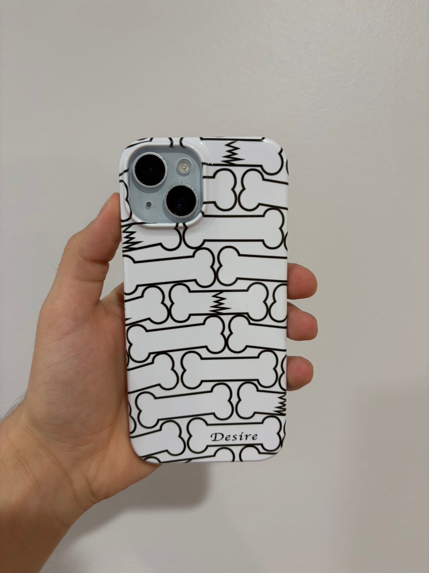 broken bones case