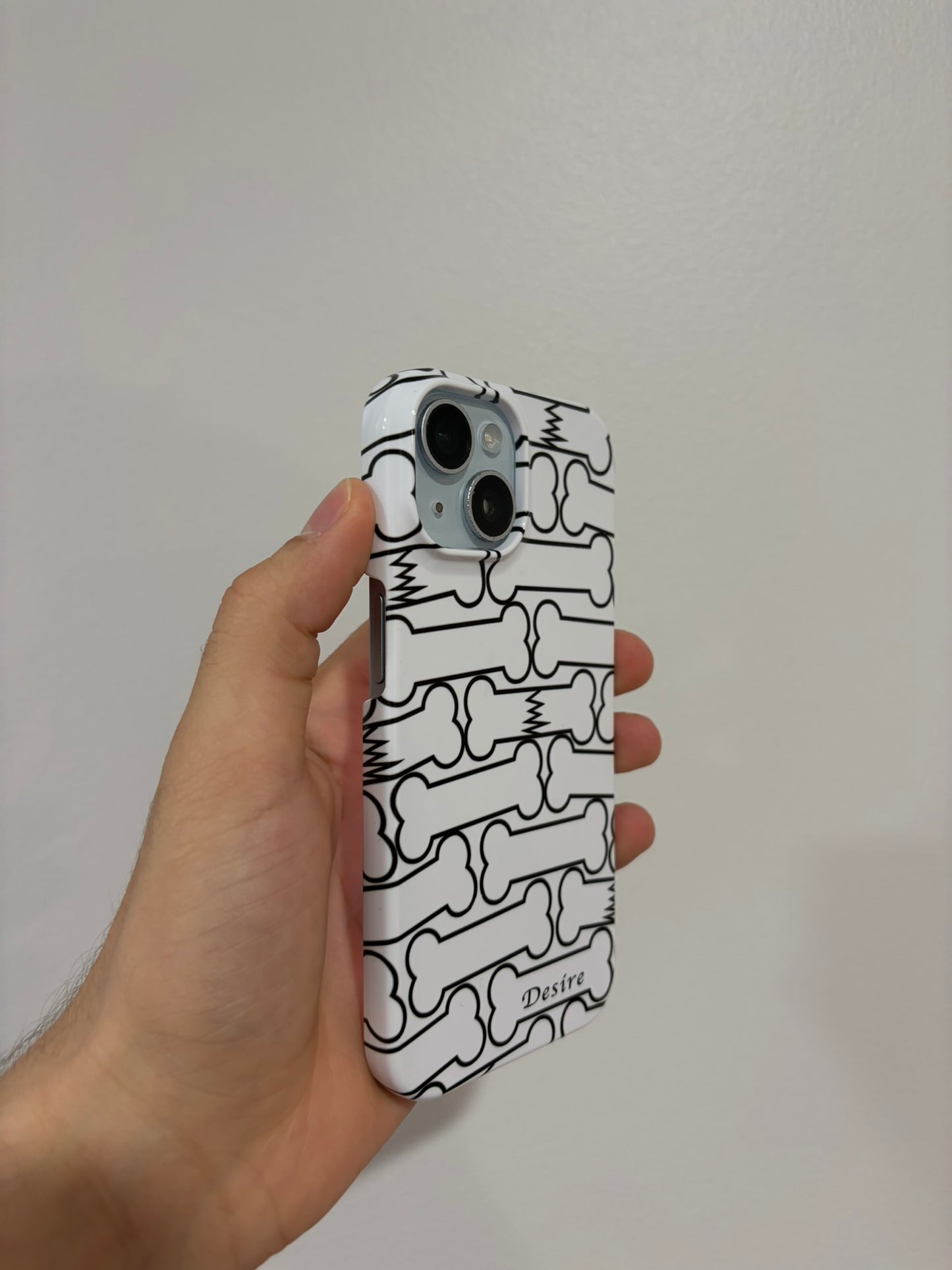 broken bones case