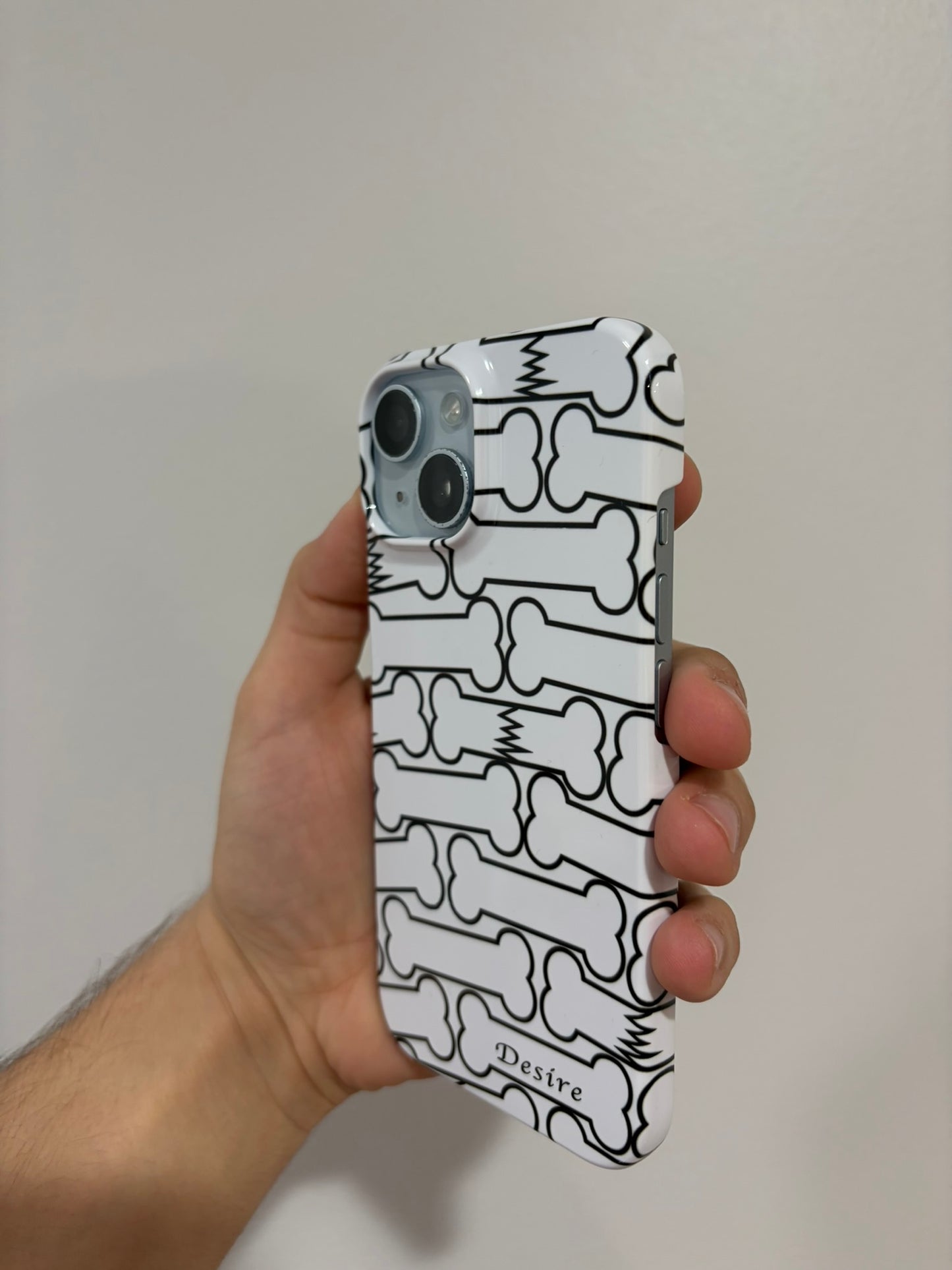 broken bones case